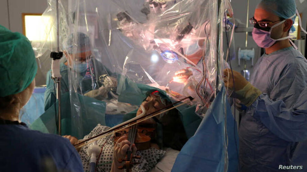 درمان تومور مغزی