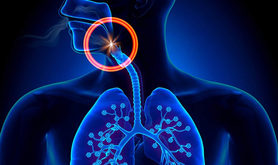 پنومونی آسپیراسیون