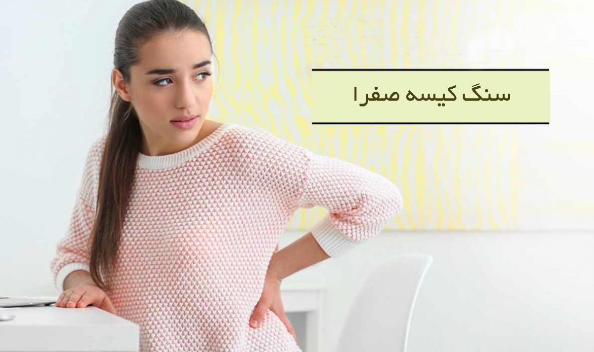 پیشگیری از سنگ کیسه صفرا