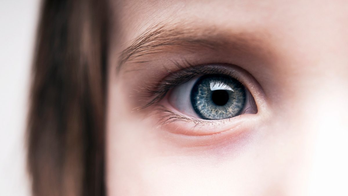 لبر یا آموروزیس مادرزادی