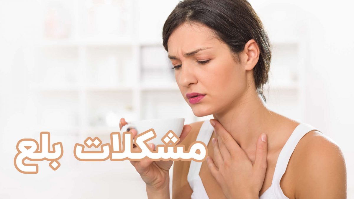 مدیریت مشکلات بلع