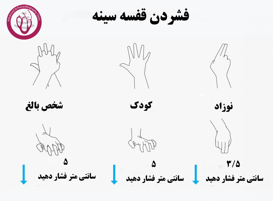 انواع شردن قفسه سینه در احیای قلبی - ریوی