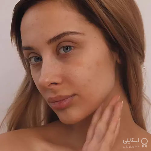 آماده سازی پوست