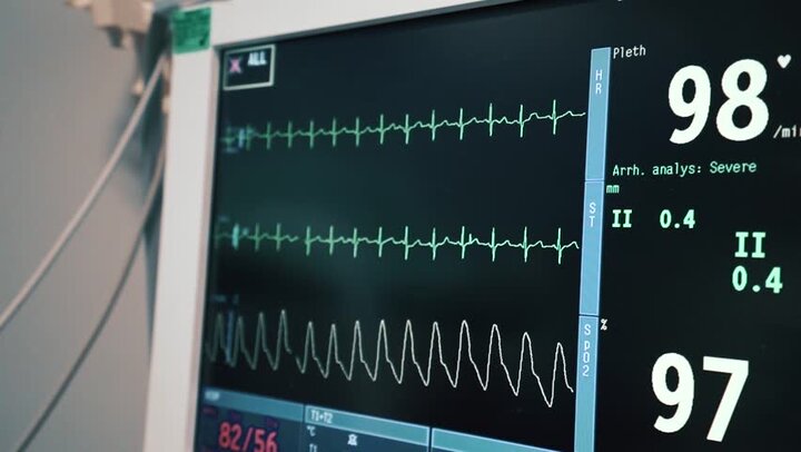 اگر بعضی از عوامل پر خطر ابتلا به بیماری قلبی یا سابقهی خانوادگی این نوع بیماری را داشته باشید، پزشک شما را تشویق میکند تا از سنین پایینتر چک آپ قلب را شروع کنید.