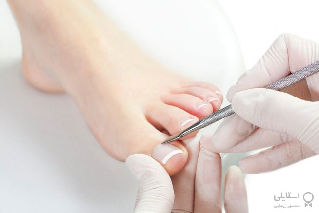 از بین بردن کثیفی‌های پا