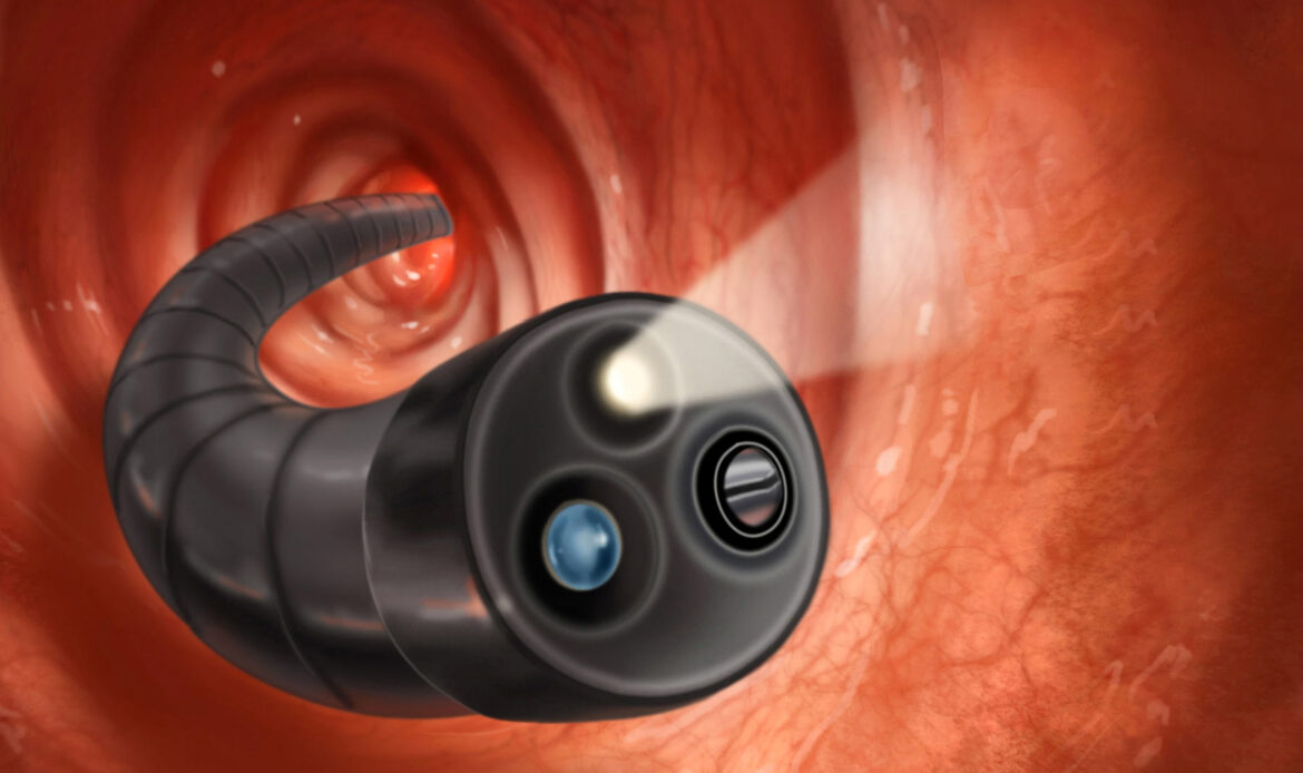 کولونوسکوپی چیست