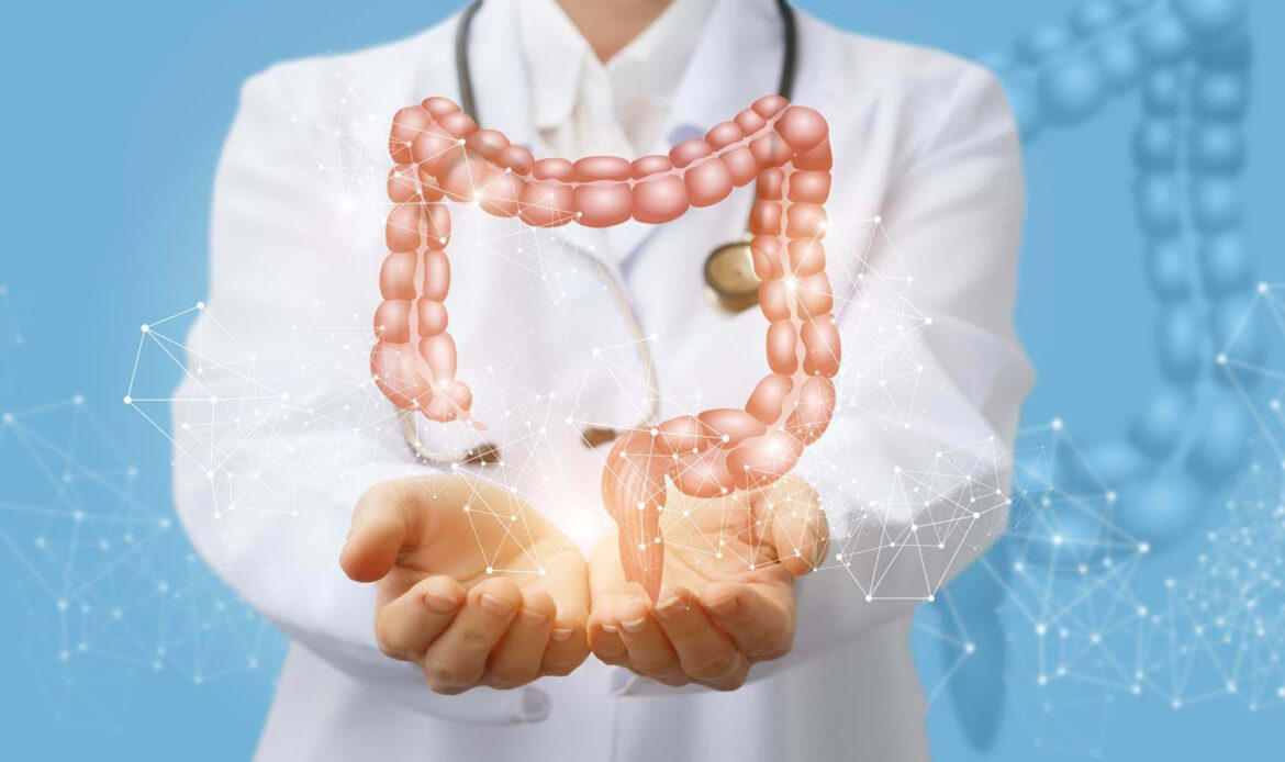 سندروم روده تحریک پذیر