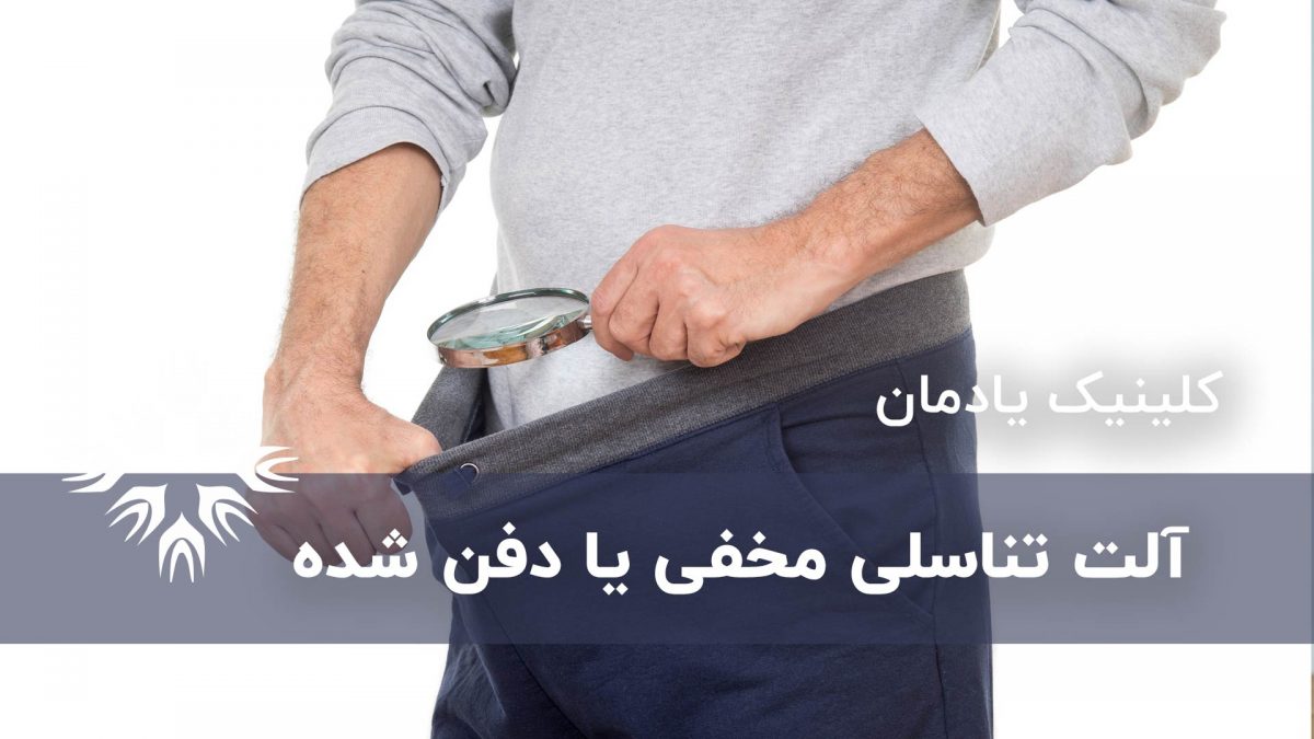 آلت تناسلی مخفی یا دفن شده