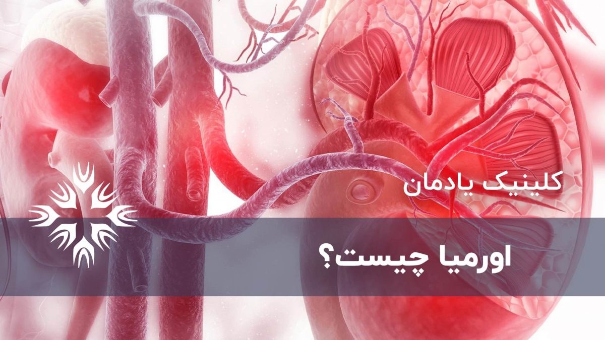 اورمیا چیست علائم و گزینه های درمان