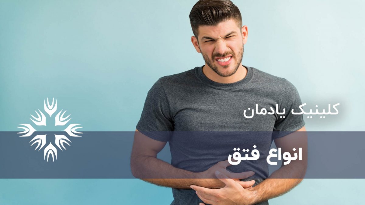 بررسی 6 نوع از انواع فتق