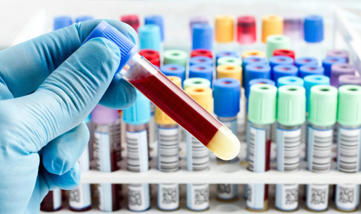 تشخیص بیماری التهاب روده (IBD)