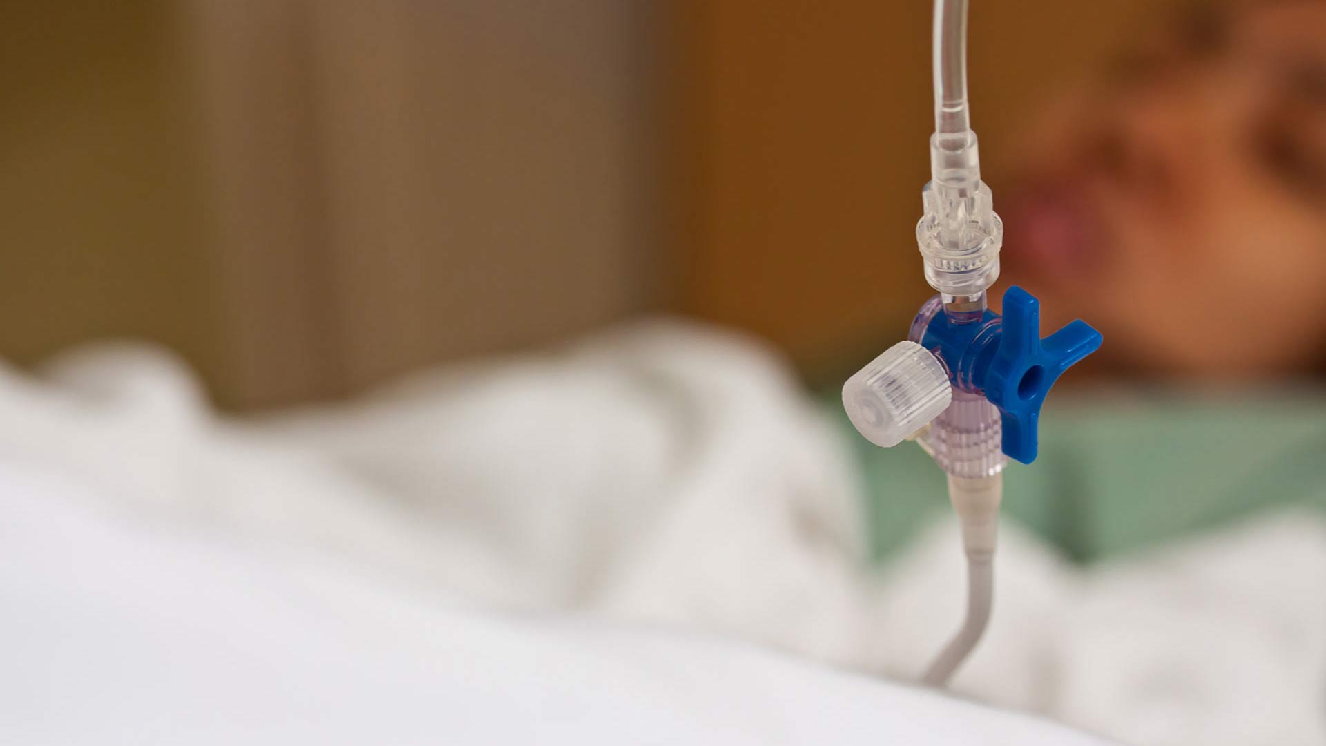 انواع لوله­ های تغذیه و موارد استفاده آنها