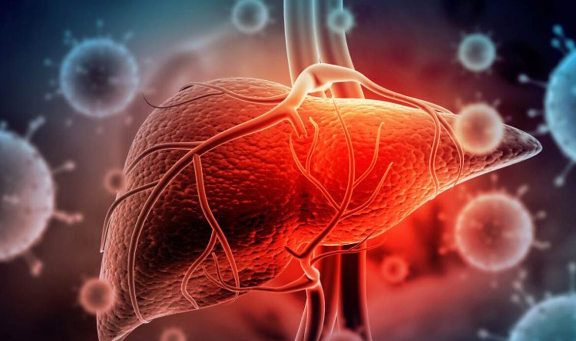 هپاتیت و درد بالای شکم