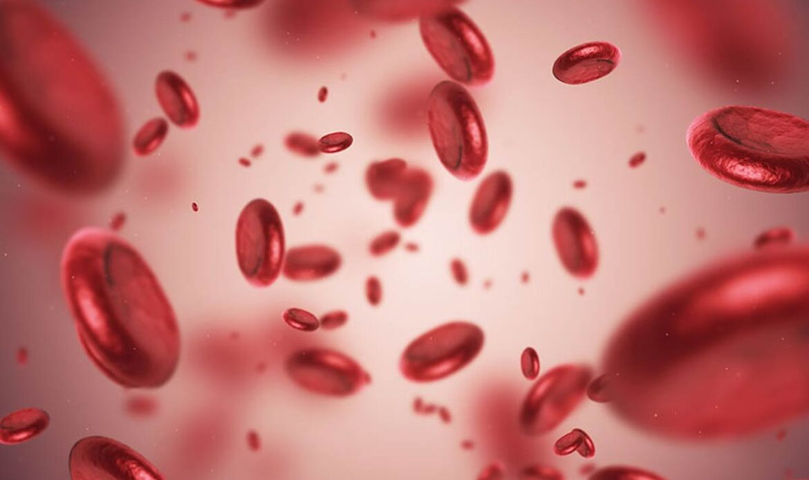 کمبود فقر آهن