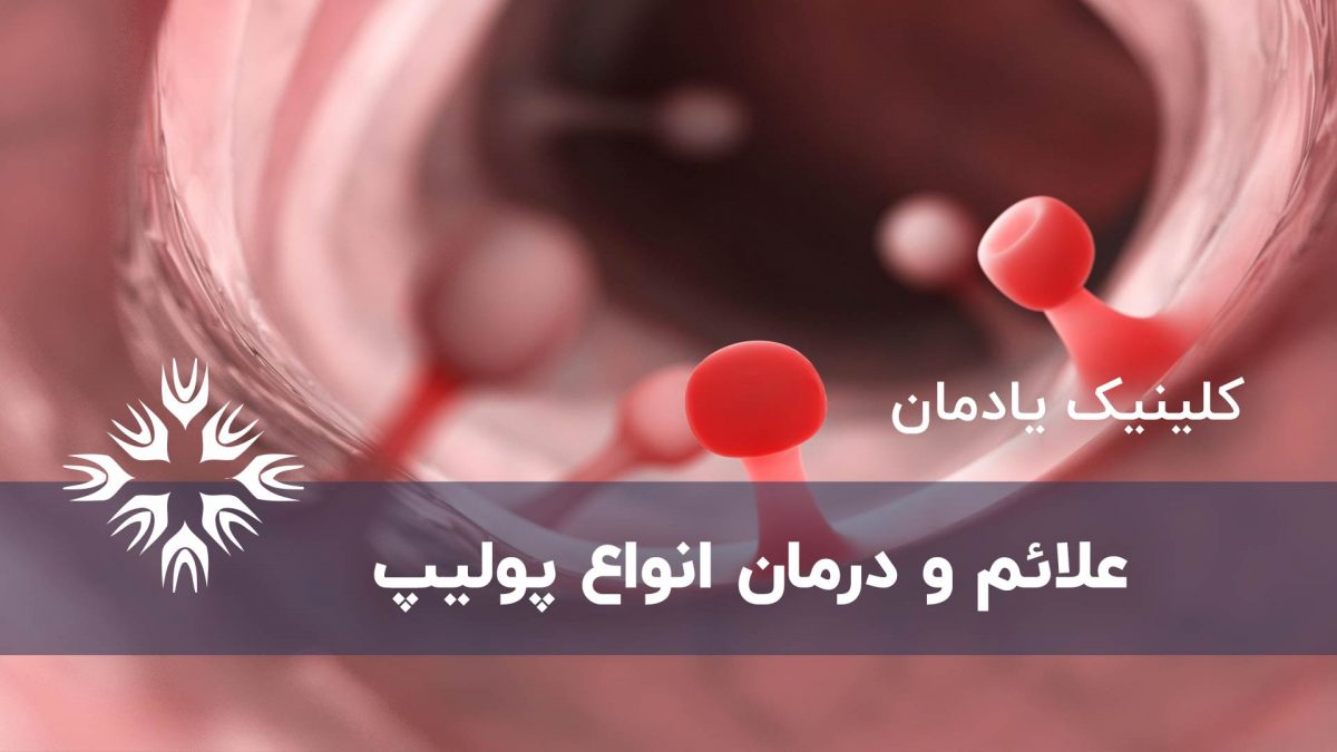 روش های درمان انواع پولیپ ، علائم و تشخیص