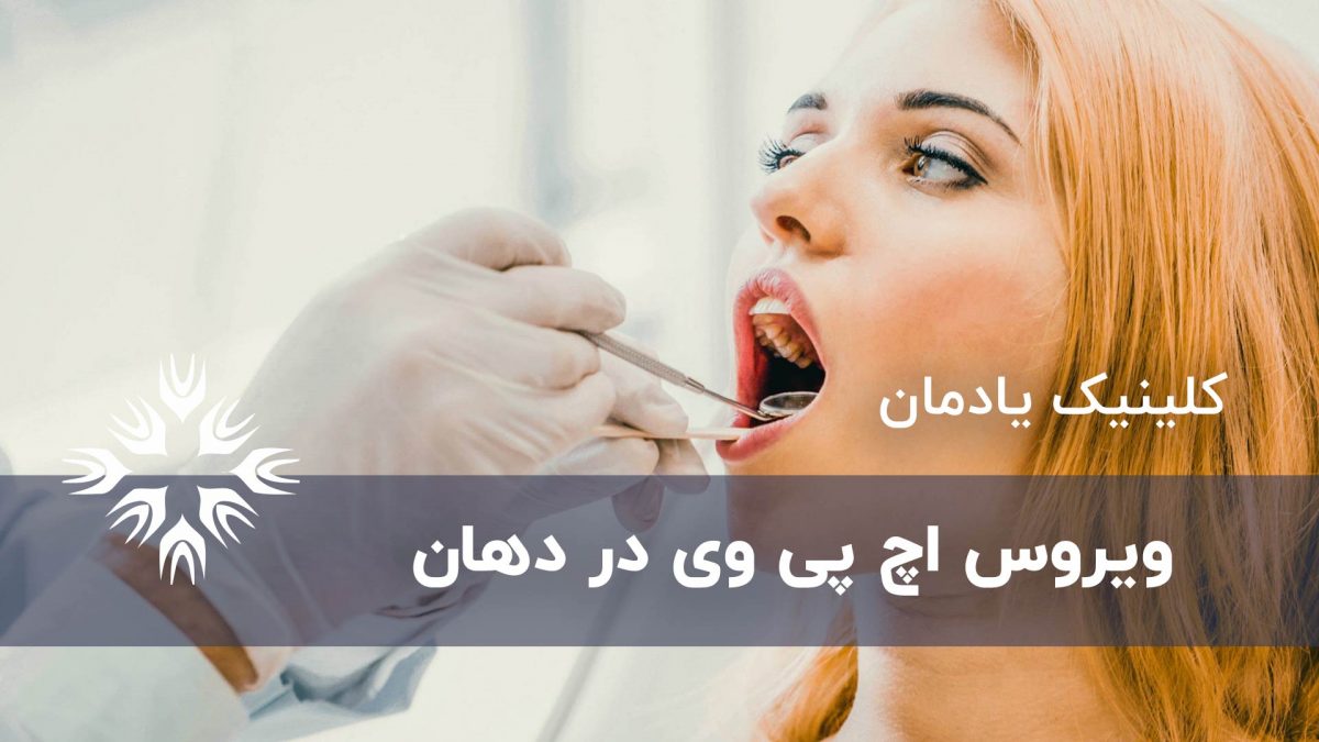 ظاهر شدن نشانه های اچ پی وی و زگیل تناسلی در دهان