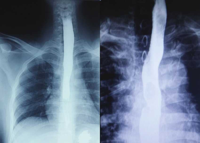 باریوم سوالو