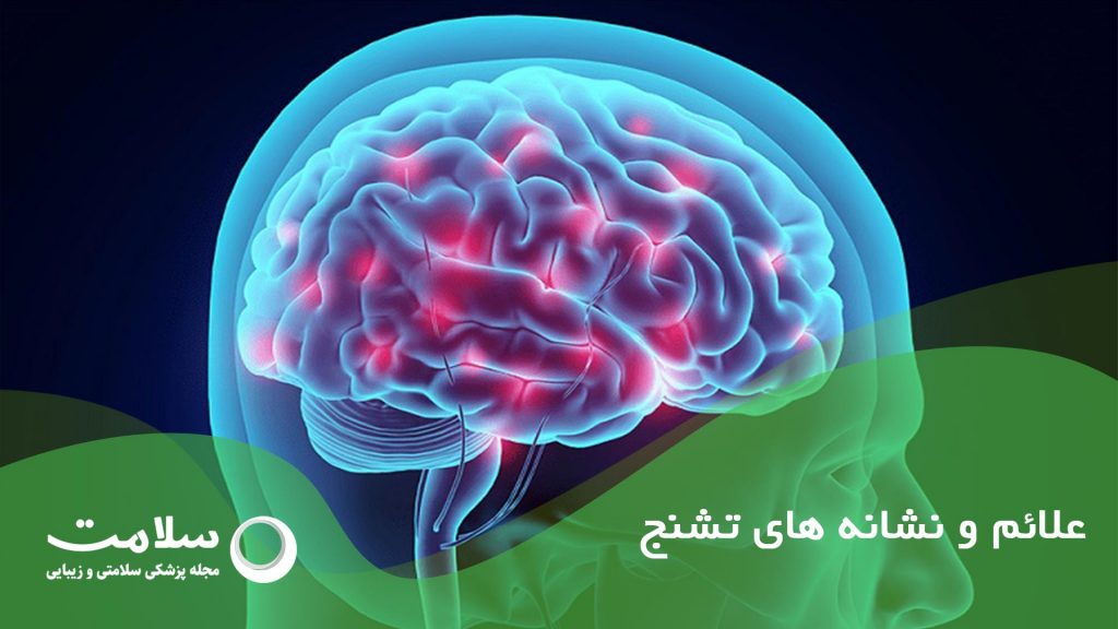 علائم و نشانه های تشنج