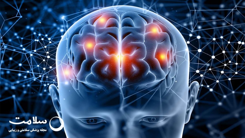 علائم تشنج در بزرگسالان