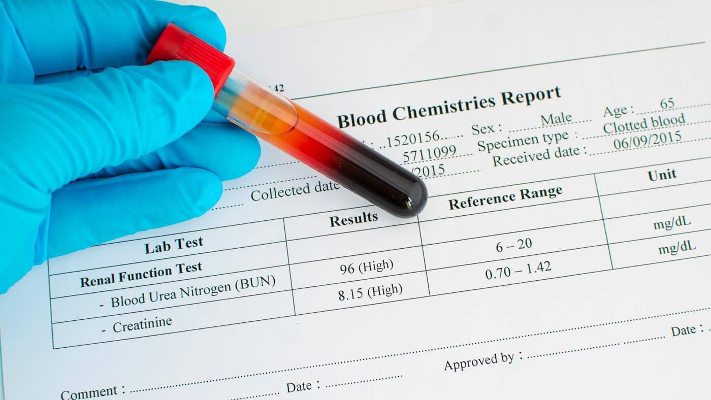 انواع تست خون