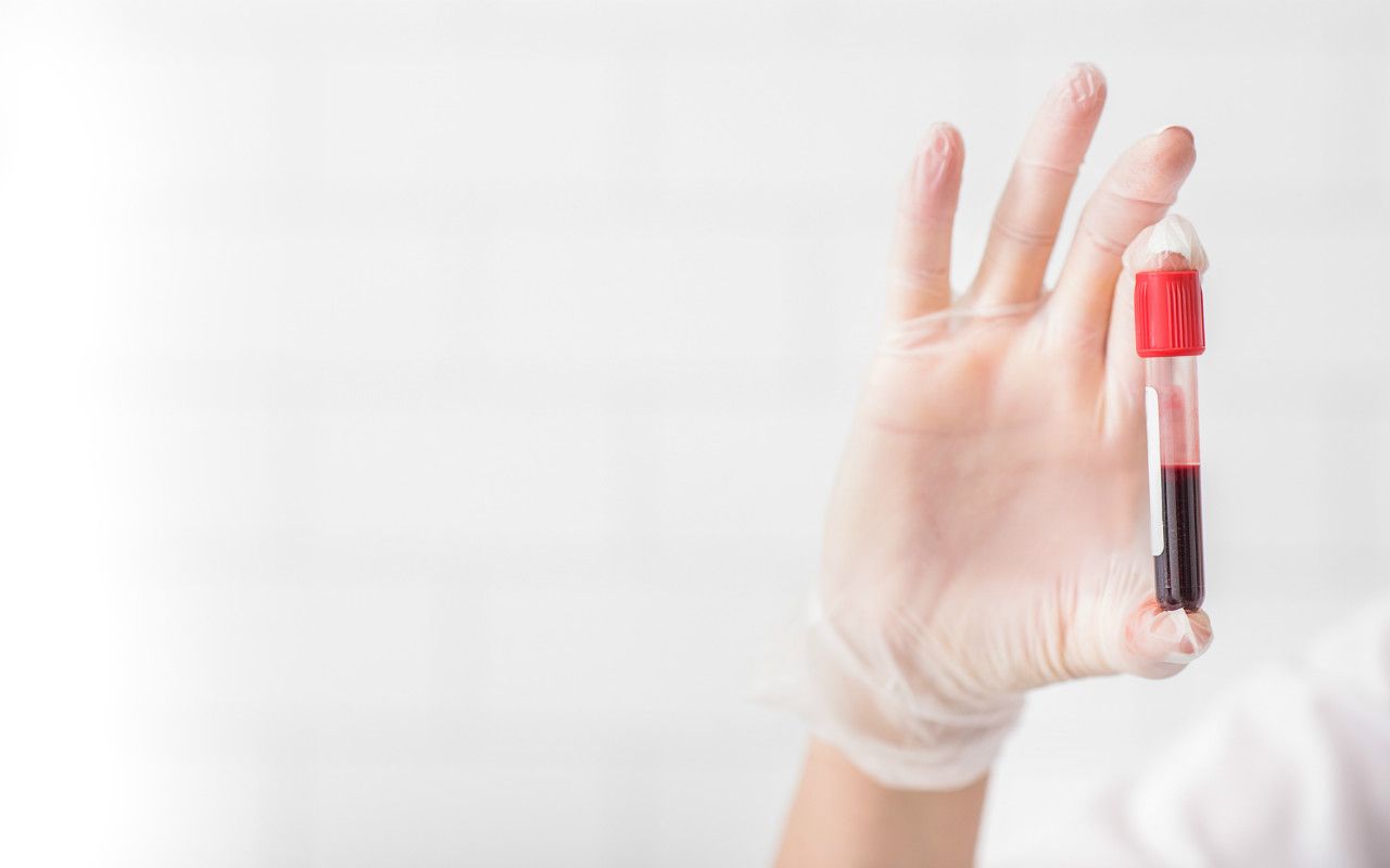 زمان آزمایش خون