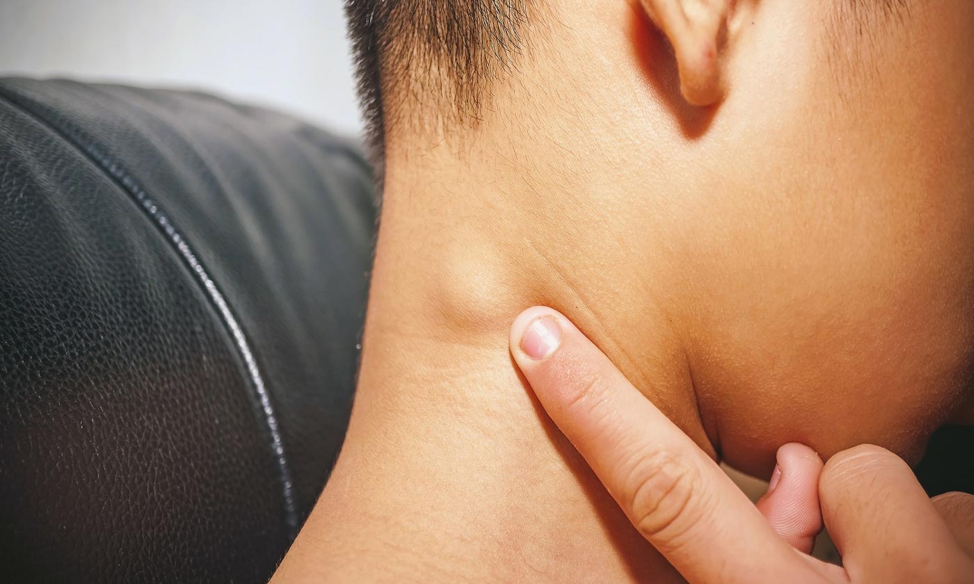 علائم سرطان غدد لنفاوی