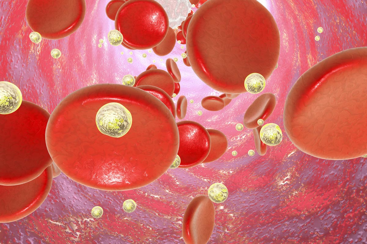 گلبول های سفید