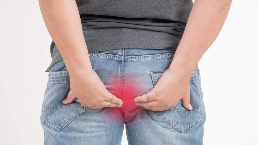 فیستول مقعدی