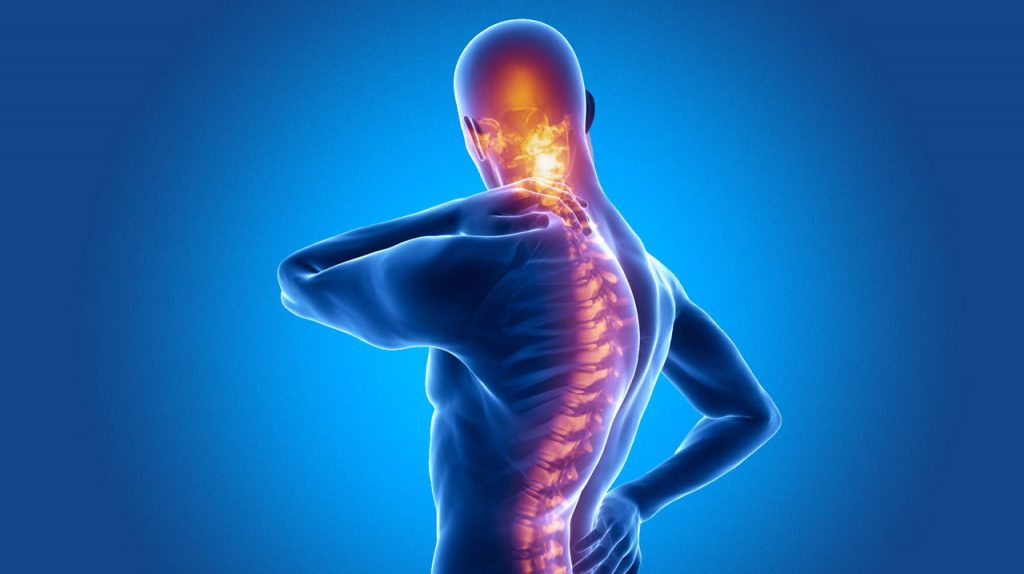 اسپوندیلیت آنکیلوزان