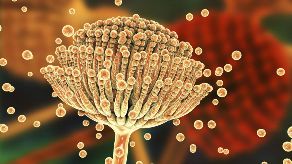 آسپرژیلوزیس