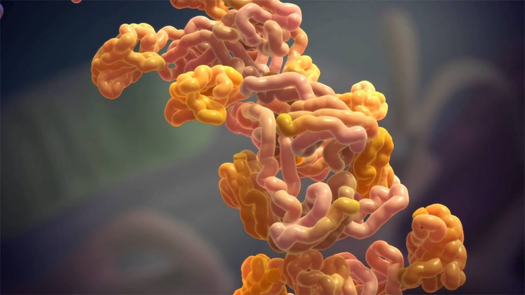 آمیلوئیدوز