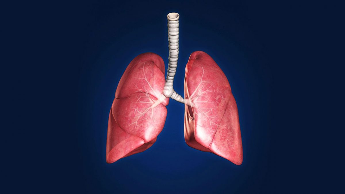بیماری آزبستوز چیست؟ علائم و درمان