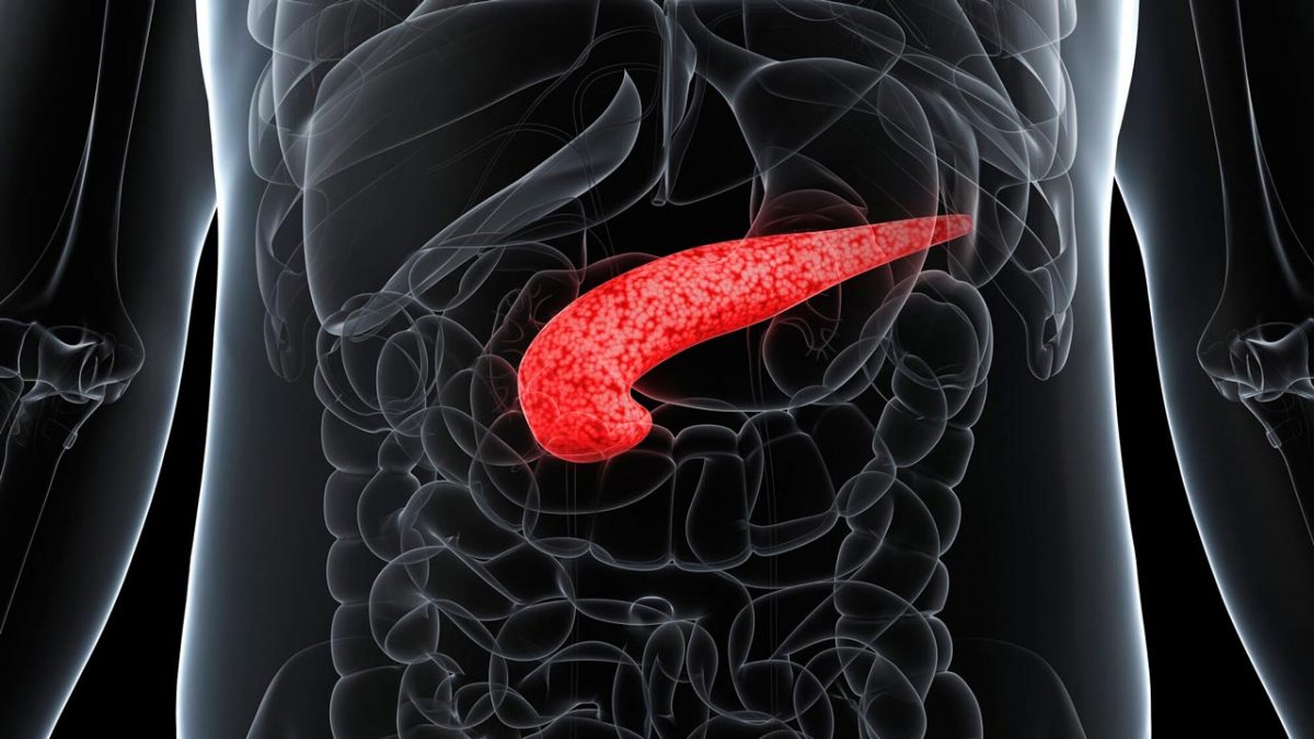 پانکراتیت حاد چیست؟