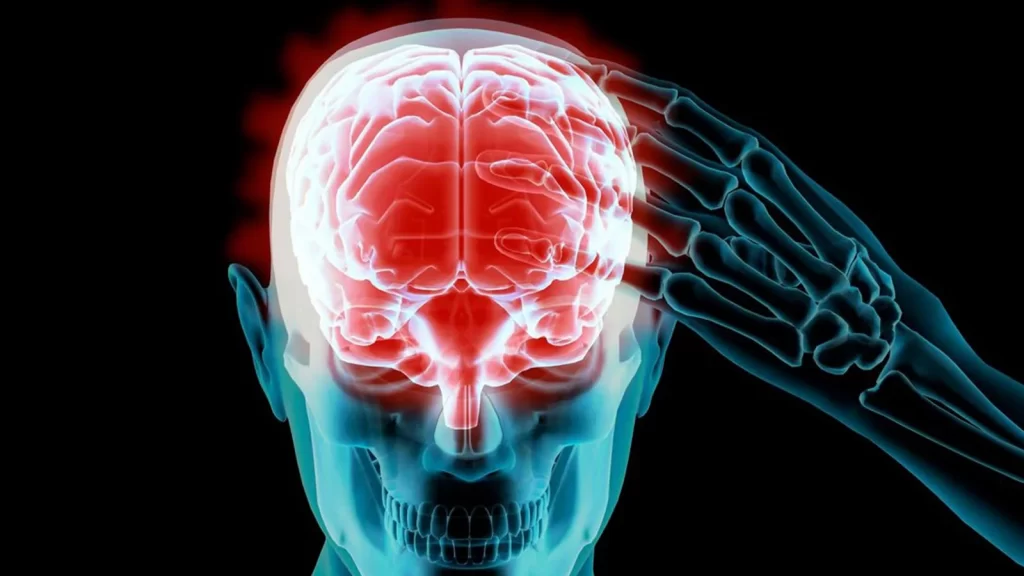 درد در ناحیه مغز 